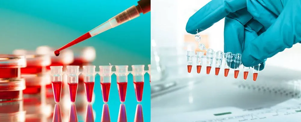 lab pcr tube 12 stripe applications